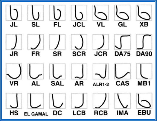 心臟介入源起導尿管插入心臟？