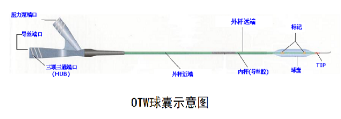 PTCA球囊導(dǎo)管的種類， 預(yù)擴(kuò)張與后擴(kuò)張是什么意思？