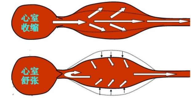 血壓？ 為什么需要做有創(chuàng)血壓監(jiān)測(cè)
