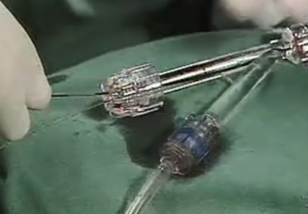 產(chǎn)品介紹：  一次性使用Y型連接閥