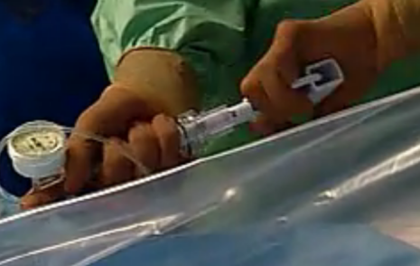 產(chǎn)品推薦：一次性使用球囊擴充壓力泵