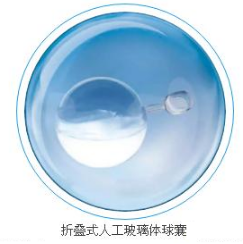 球囊技術(shù)在醫(yī)學(xué)上的應(yīng)用