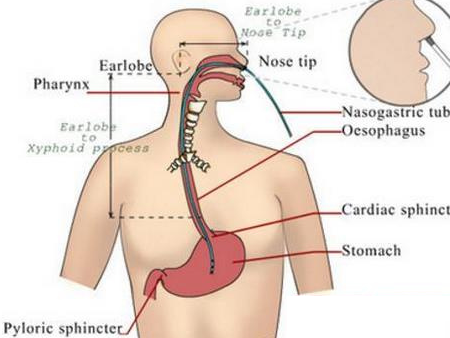 益心達(dá)又有多個(gè)產(chǎn)品獲上市許可
