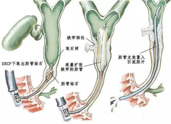 益心達(dá)又有多個(gè)產(chǎn)品獲上市許可