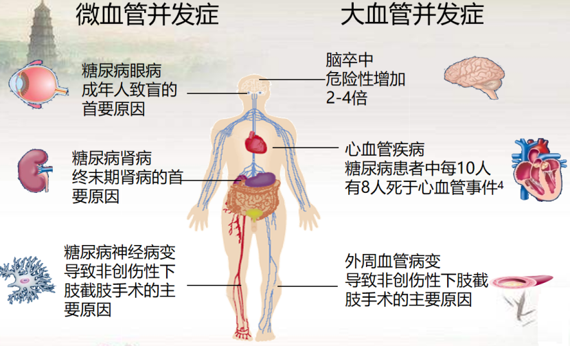 糖尿病的血管病變
