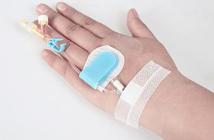 動(dòng)脈留置針采購(gòu)