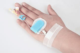 手術(shù)動脈留置針