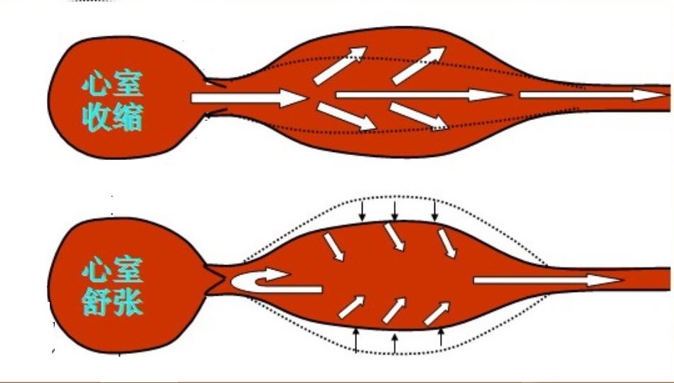  為什么需要做有創(chuàng)血壓監(jiān)測(cè)