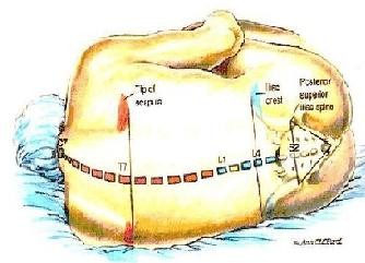 椎管內(nèi)麻醉比較