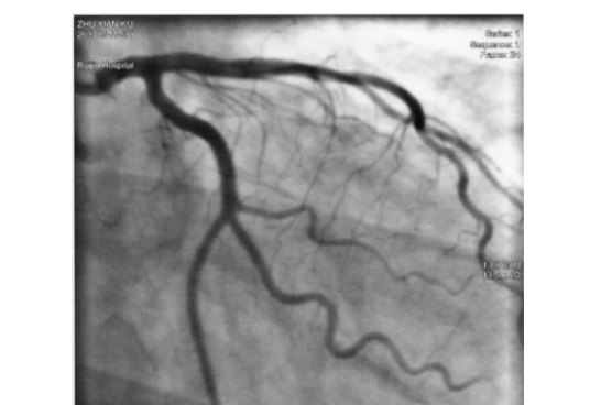 指引導(dǎo)管生產(chǎn)廠家
