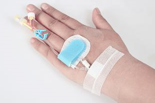 動脈留置針生產(chǎn)廠家推薦益心達