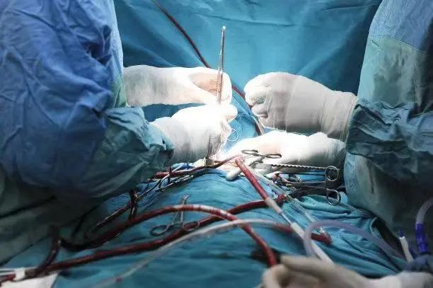 心內(nèi)介入延長導(dǎo)管